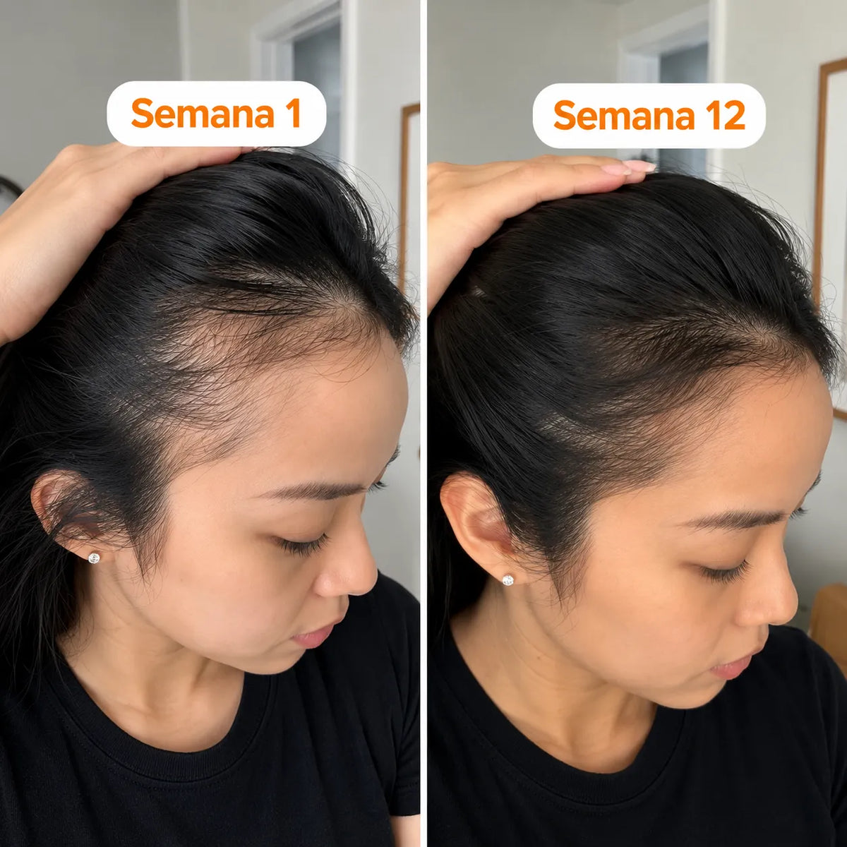 Growturn Serum para El Crecimiento Capilar