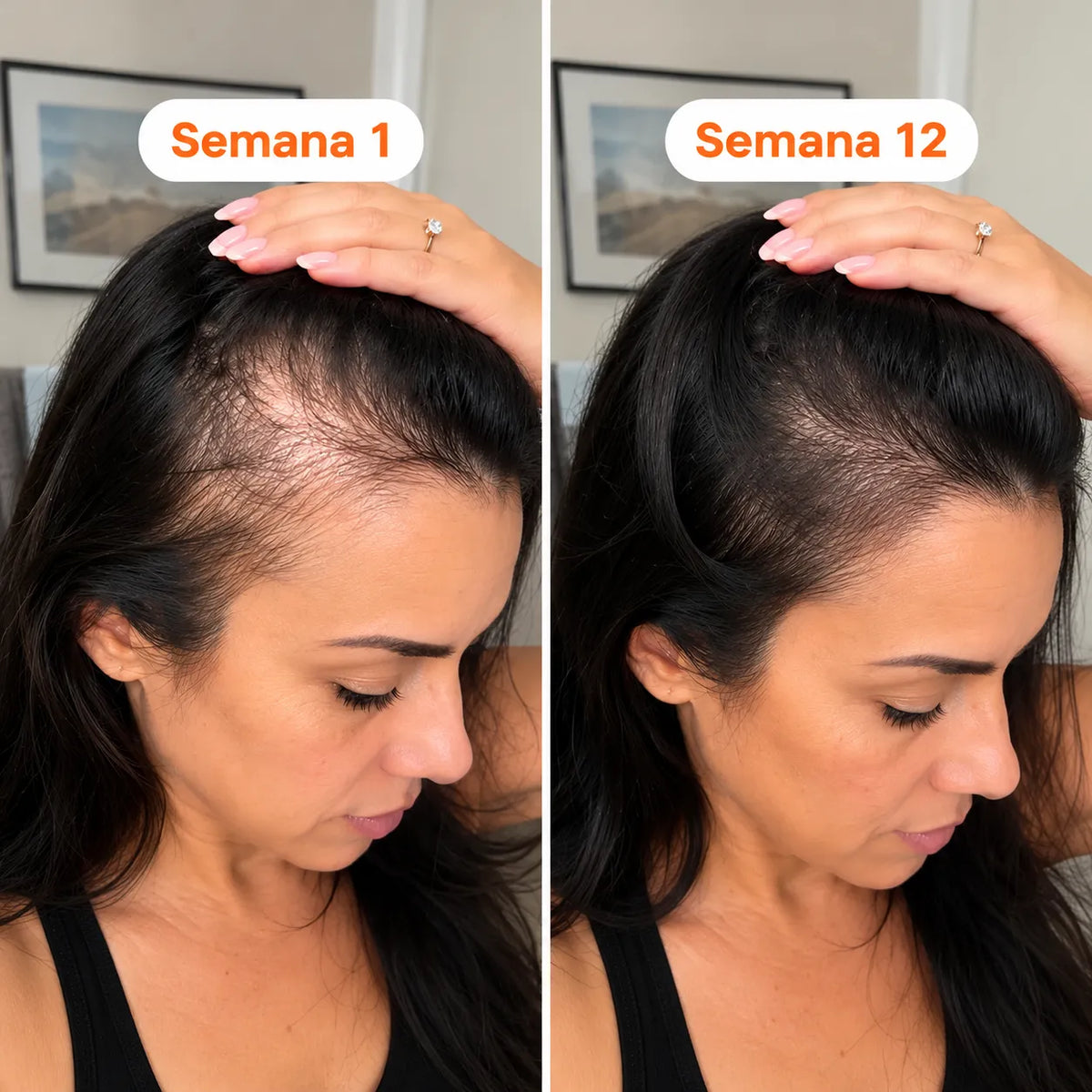 Growturn Serum para El Crecimiento Capilar