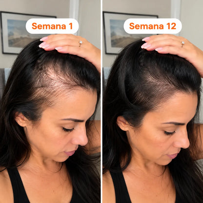 Growturn Serum para El Crecimiento Capilar